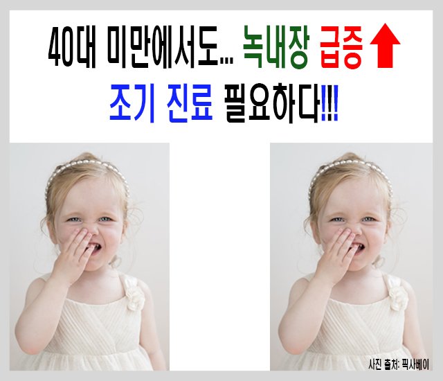 [눈 건강 #3] 40대 미만에서도 녹내장 급증-1.jpg